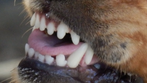 Young man injured in dog attack in Inishowen rushed to hospital for treatment