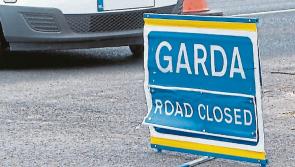 National: Young man being treated for serious injuries after an early morning hit-and-run